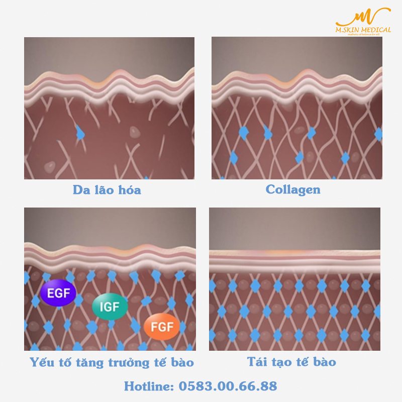 Tái tạo Collagen & Elastin trong quá trình phân giải mỡ