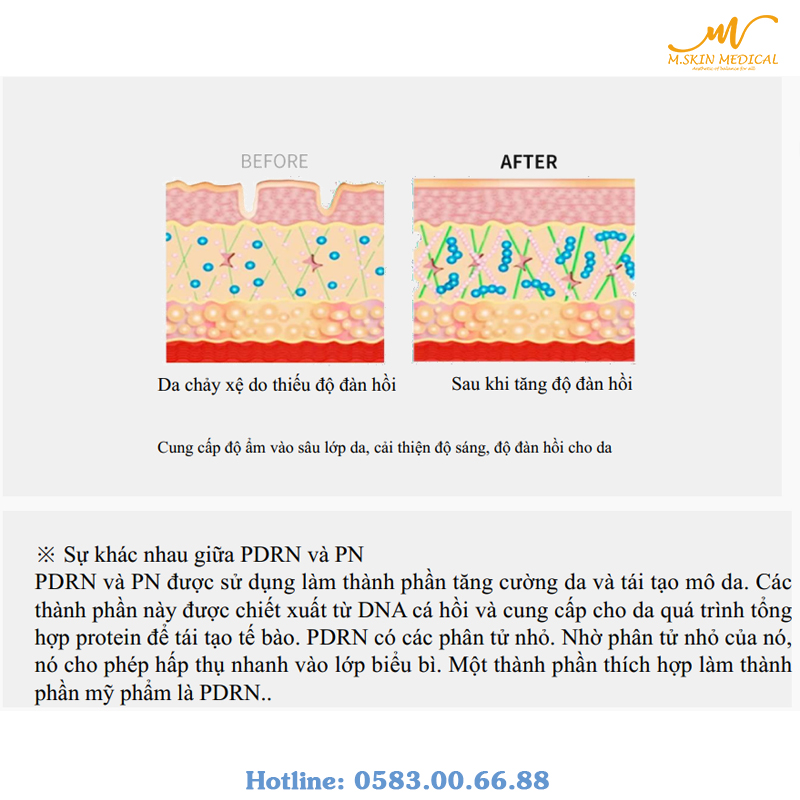 Trẻ hóa da PDRN -  Sidium DNA PDRN