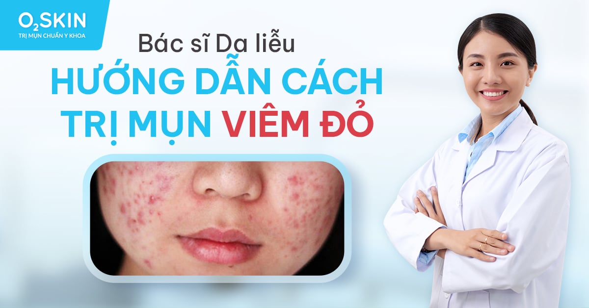 Mụn Viêm Là Gì? Cách Chăm Sóc Mụn Viêm Tại Nhà Đúng Cách